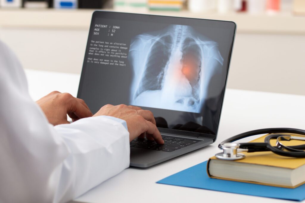 KNOWvember is lung cancer awareness month and while statistics show mortality rates have been decreasing