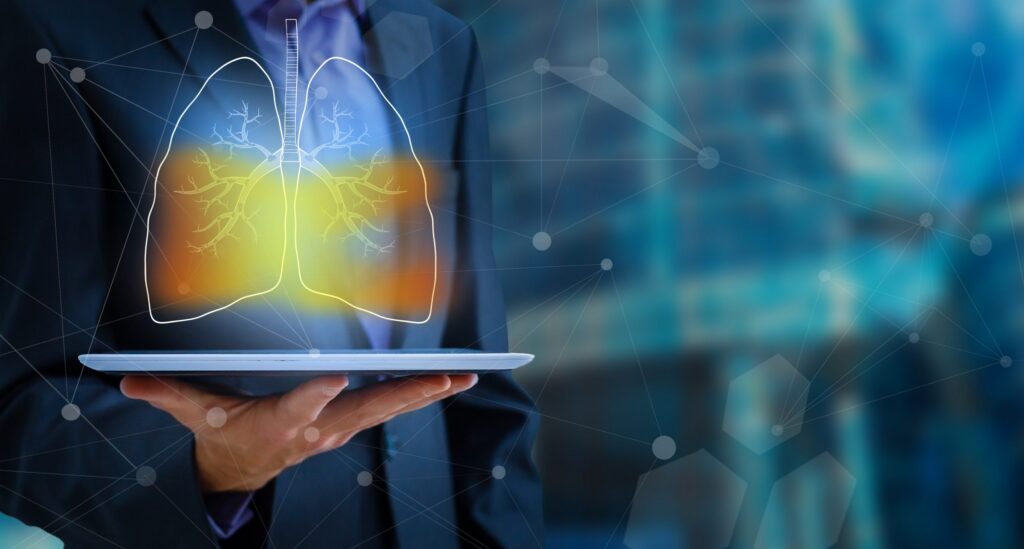 There is work to be done to prevent severe lung cancer cases