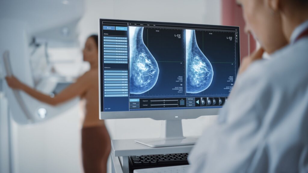 The Limits of Mammography In this 5-part Breast Health Series