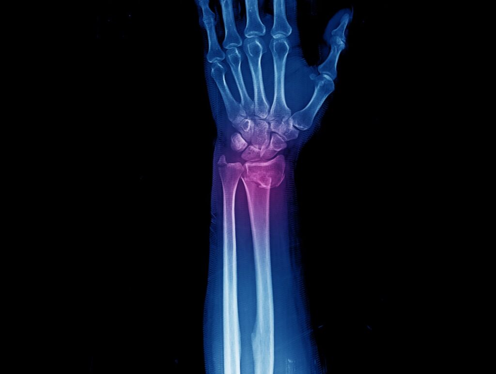 This week’s Domain Knowledge highlights recent developments in fracture detection AI.