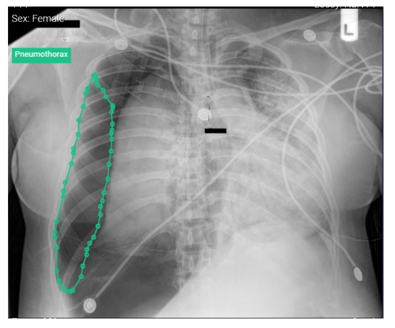 VinBrain’s DrAid™ Teleradiology solution is immediately available on the Ferrum AI Hub platform. DrAid leverages AI in radiology to support healthcare professionals in detecting abnormalities on chest x-rays.