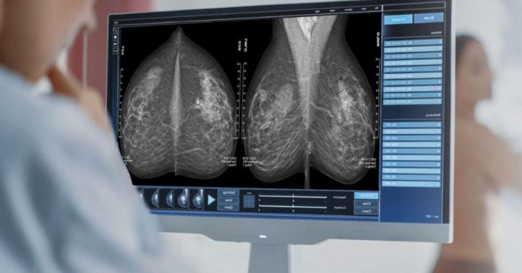 Ferrum Health announces their latest partnership with iCAD
