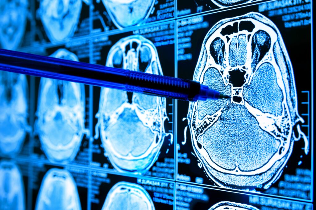 Radiologists play a key role in cancer detection and AI can be an invaluable tool in assisting with the identification of cancer in medical imaging studies.